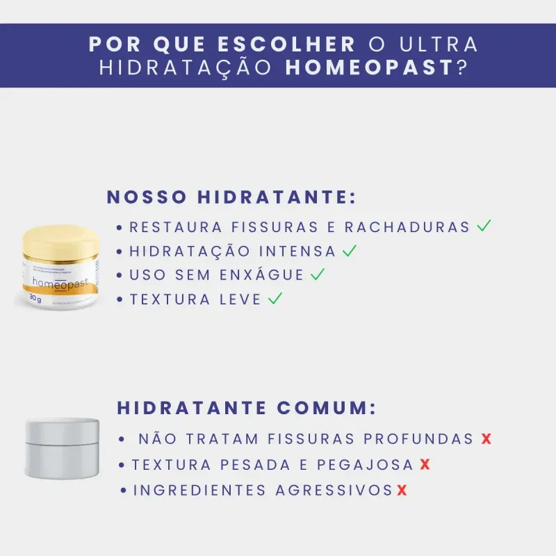 creme_ultra_hidratacao_30g_areas_ressecadas_pes_joelhos_e_cotovelos_7_8_43d6063337cf5ae75b98d0ab8a0bd455